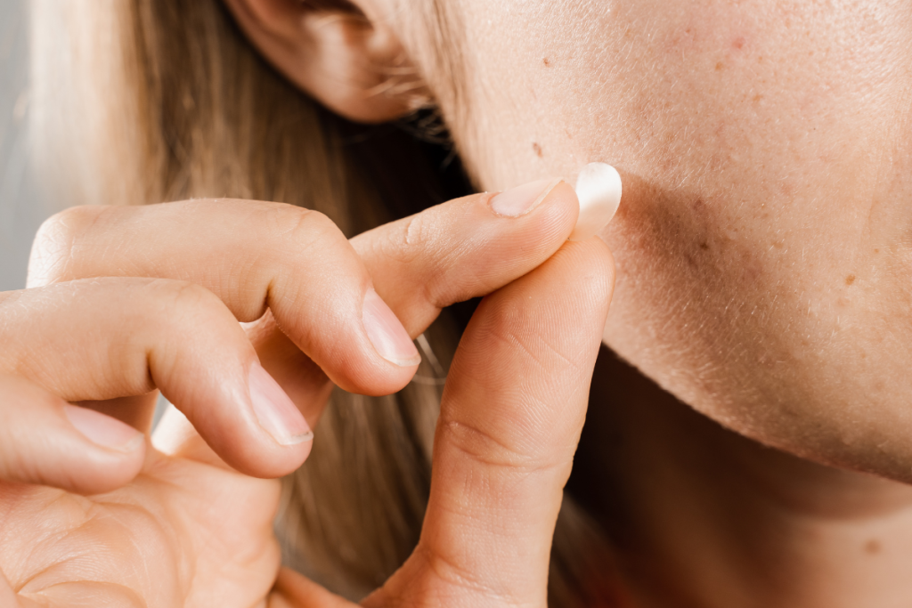 A close-up of a person applying a small round pimple patch to their cheek.